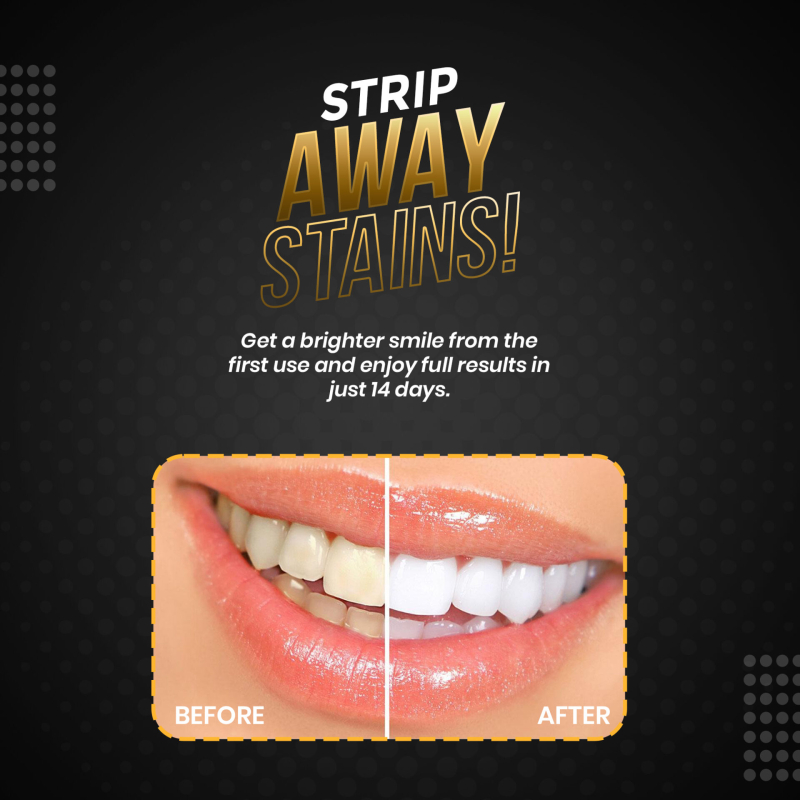 Teeth Whitening Strips With Activated Charcoal & Pap+ - Image 5